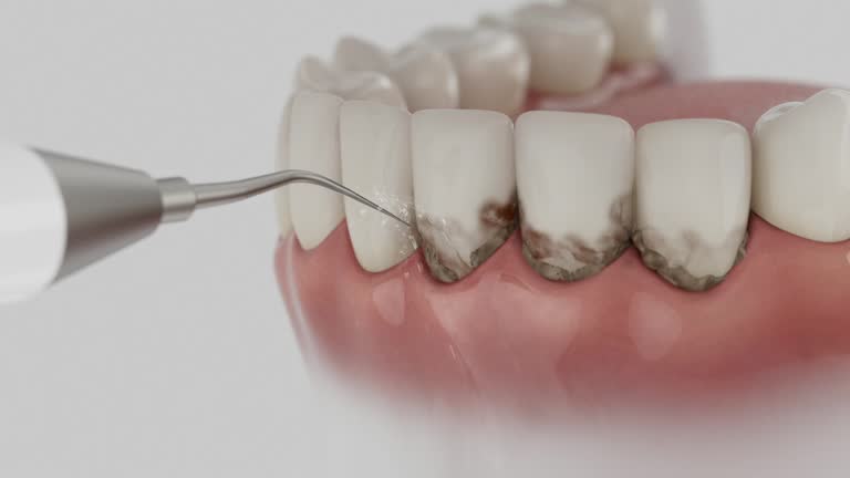 Reliable Dental contractor in Angola, IN by Dentist Open Now